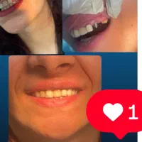 دندانپزشکی اقساطی بدون پیش‌پرداخت