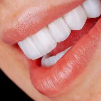 * عکس OPG رایگان در کلینیک تخصصی دندانپزشکی *