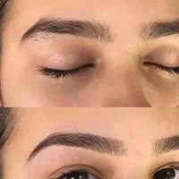 اصلاح صورت بانوان