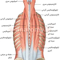 دیسک کمر گردن شانه دررفتگی کایروپراکتیک