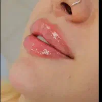 تخفیف ویژه   فیلر، بوتاکس‌، لیزر‌ و لاغری فشیال