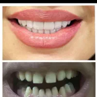 آموزش کامل دندانپزشکی بصورت اقساط