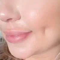 مطب ،زیبایی
