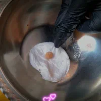 تخفیف ویژه ی برداشتن خال و لک و کک ومک و زگیل
