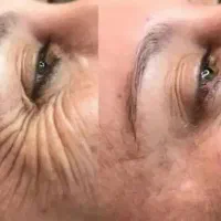 کرم بیوممتیک ضد چین و چروک پرداخت اقساطی ۴ ماهه