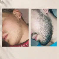 ضخیم و پرترش کنی قشنگ‌تره