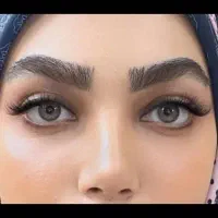 کاشت ابرو