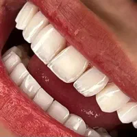 اموزش کامپوزیت از مبتدی تا حرفه ایی