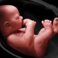 متقاضی دریافت تخمک اهدایی