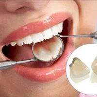 دندانپزشکی با قیمت دولتی