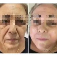 جشنواره تایکشنبه)هایفو گلدفقط1/950با20خدمات رایگان