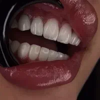 کامپوزیت فیسینگ با ده سال سابقه کاری موفق