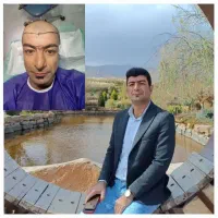 جشنواره کاشت ابرو و مو
