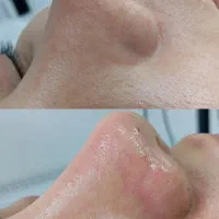 فیشال و پاکسازی تخصصی