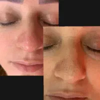 پاکسازی پوست با 495 تومن فقط امروز