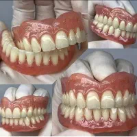 دندانسازی     بابک. لبخند زیبا