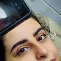 میکروپیگمنتیشن