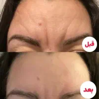 کرم  ضد آفتاب بیرنگ ویتابلا