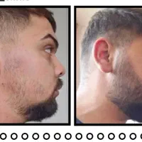 ریش هاتو پرپشت کن