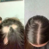 آبرسانی فلیکولی بمب تغذیه پیازچه تضمینی
