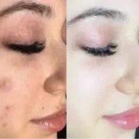 پوست‌ شیشه ای با کرم vip اماراتی