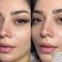 مدل اکستیشن مژه