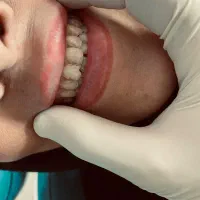افر ویژه وینر کامپوزیت
