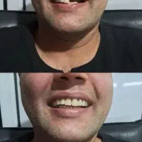 دندانسازی ،دندان مصنوعی،مشهد