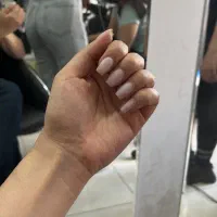 آفر ویژه کاشت و‌ترمیم ناخن