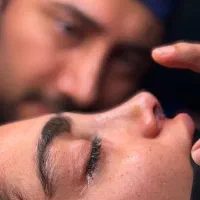 عمل جراحی بینی فقط با ۳۵ میلیون تومن