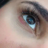 مدل اکستنشن کلاسیک