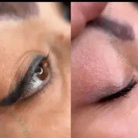 اموزش صفرتاصد ریمووتخصصی صورت وبدن