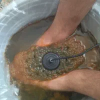 سم زدایی بدن