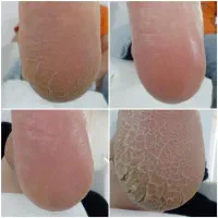 پدیکور خیس|خدمات آرایشگری و زیبایی|نهاوند, |دیوار