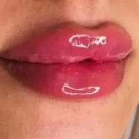 جویای کار دستیار پزشک زیبایی با۴ سال سابقه