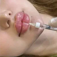 آموزش ژل بوتاکس و ....