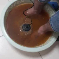 حجامت و فصد خون