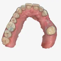 ارتودنسی شفاف دیجیتال