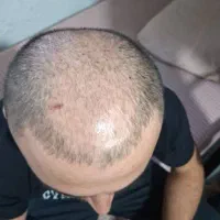 نزار یک تار مو دیگه بریزه