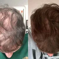 اینقدر پرپشت میشه که خسته میشی