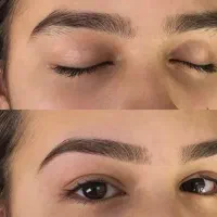 اصلاح و قرینه‌سازی ابرو