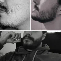 رویش و پرپشت شدن ریشات با این محصول