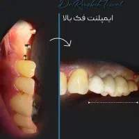ادمین حضوری اینستاگرام هستم زیبایی دندانپزشکی و..