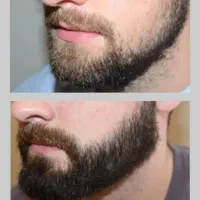 به ریشات یک فرصت دیگه بدهه