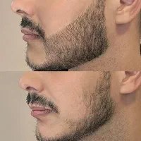 نتیجه واقعی درمانجو