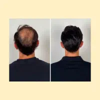 مرد باش|آرایشی، بهداشتی، درمانی|قائن, |دیوار