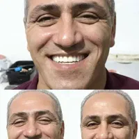 زیبایی دهان و دندان