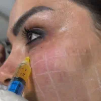 prp رایگان فقط به مدت یک روز