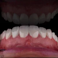 جشنواره ویژه خدمات دندانپزشکی