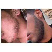 اینبار نوبت تو